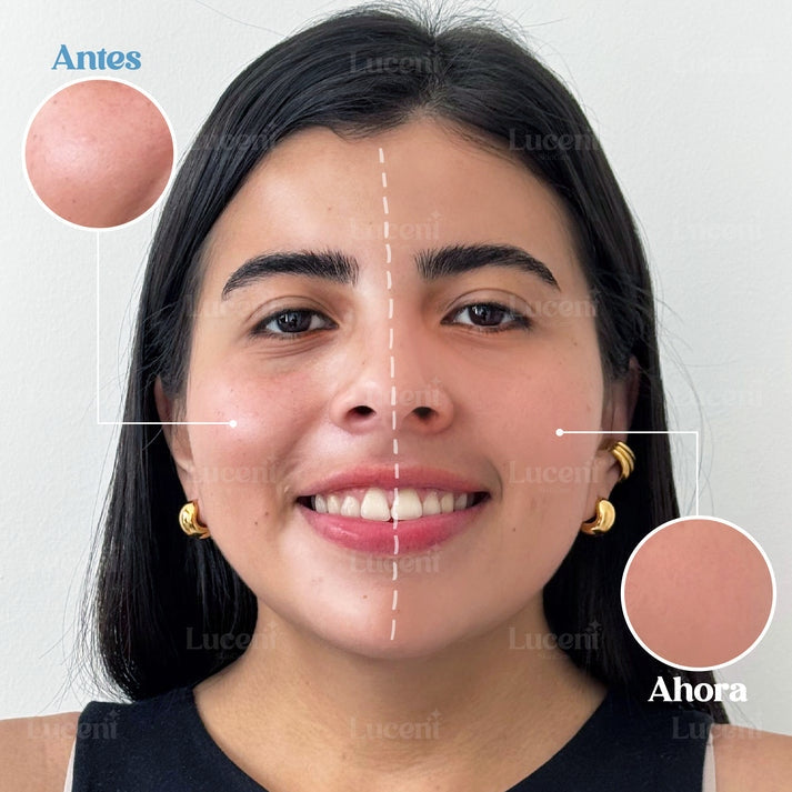 CANDY BELLA® | GEL MATIFICANTE PARA CONTROLAR LA GRASA FACIAL